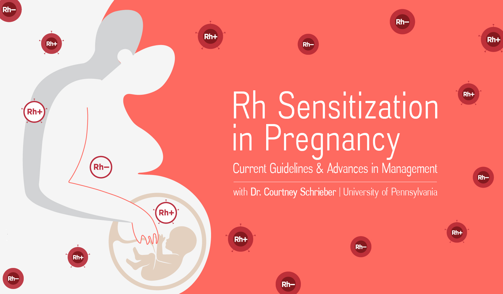 Rh Sensitization in Pregnancy – Current Guidelines & Advances in Management