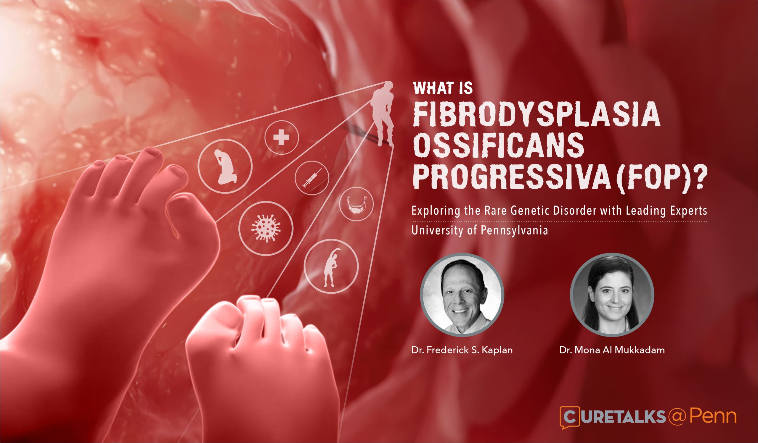 What is Fibrodysplasia Ossificans Progressiva (FOP)? Exploring the Rare Genetic Disorder with Leading Experts