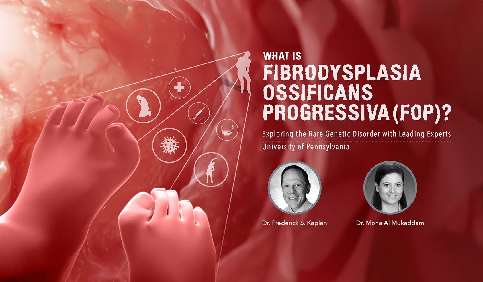 What is Fibrodysplasia Ossificans Progressiva (FOP)? Exploring the Rare Genetic Disorder with Leading Experts